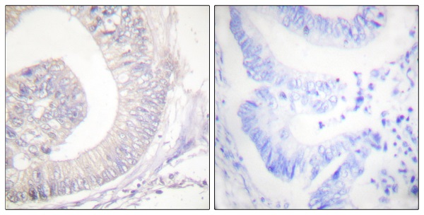 p-Hormone sensitive lipase (S853/S553) Ab