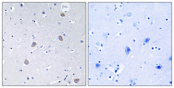 p-p70 S6 Kinase (S371) Ab