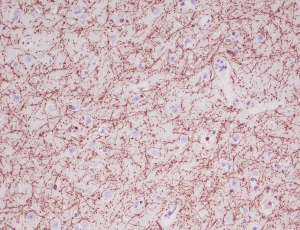 Myelin basic protein Ab