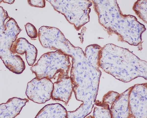 Transferrin receptor Ab