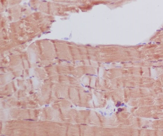 Myosin heavy chain 6/7 Ab