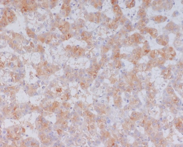 Serum amyloid A Ab