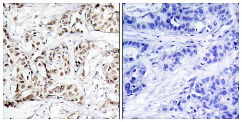 p-JNK2 (T183) Ab