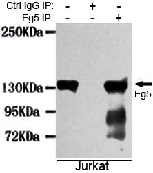 KIF11 Ab