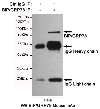 GRP78 BiP Ab