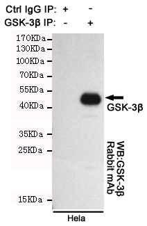 GSK 3 beta Ab