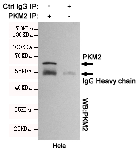 PKM Ab