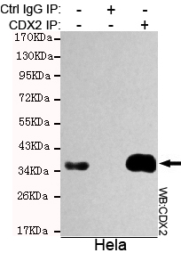 CDX2 Ab