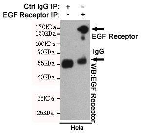 EGFR Ab