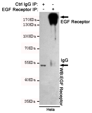 EGFR Ab