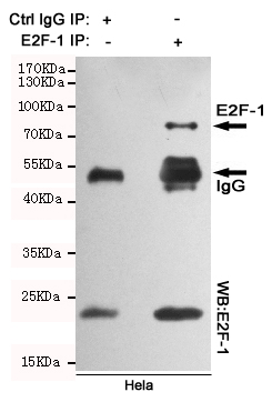 E2F1 Ab