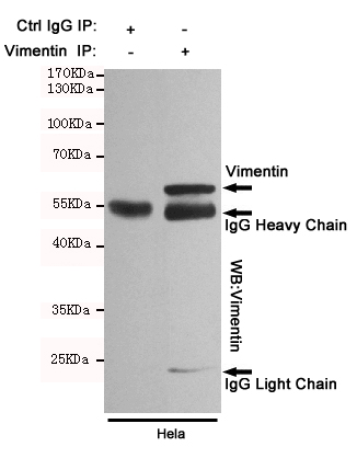 Vimentin Ab