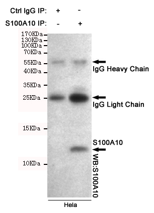 S100A10 Ab