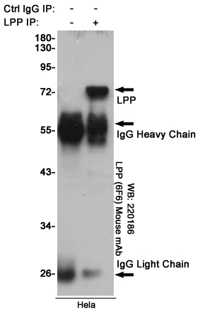 Lipoma preferred partner Ab