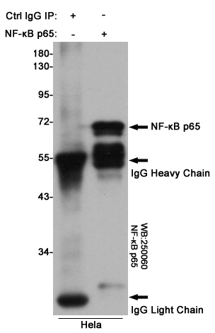 NF-kB p65 Ab