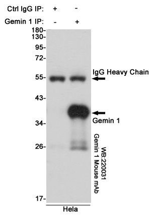 SMN1 Ab