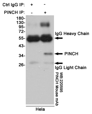 LIMS1 Ab