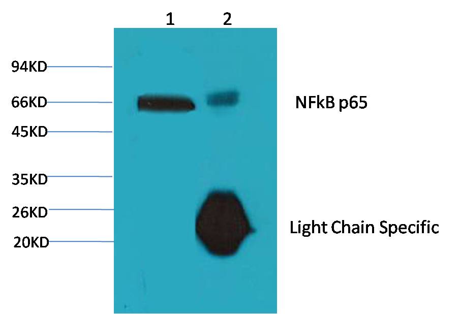 NF-kB p65 Ab