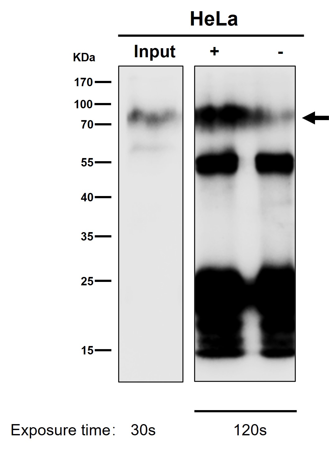 CD44 Ab