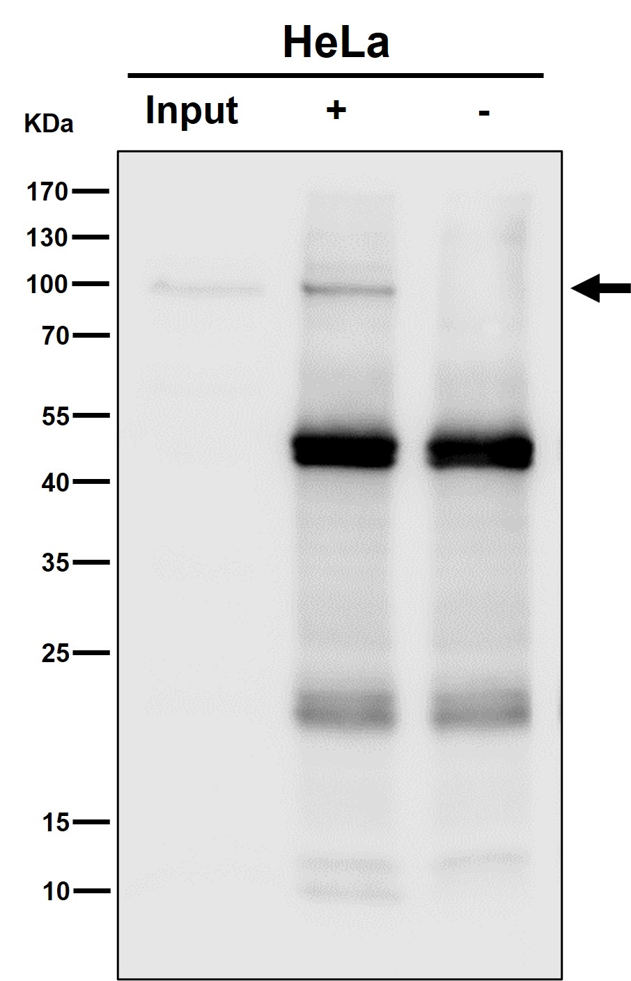 Amyloid beta A4 Ab