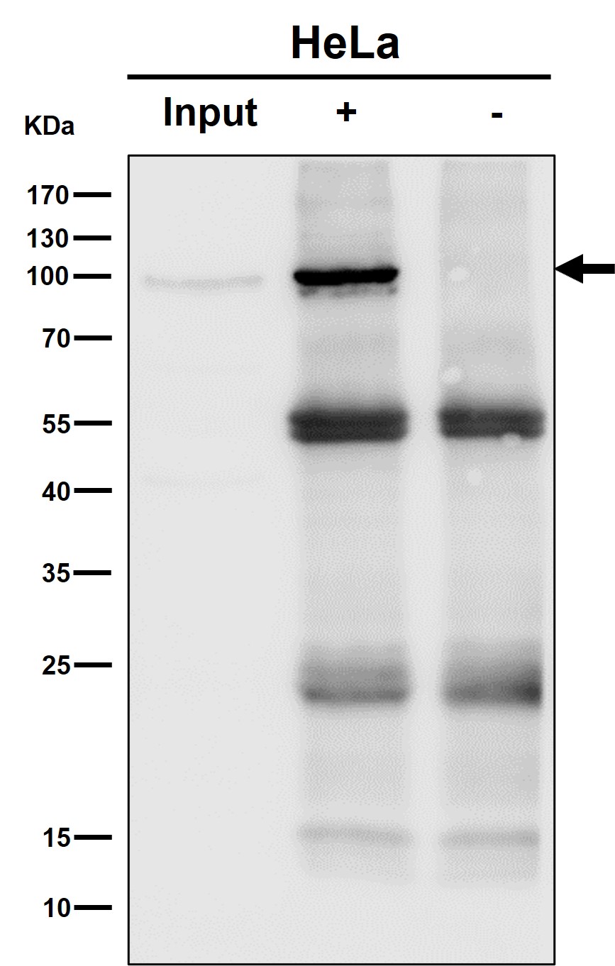 STAT6 Ab