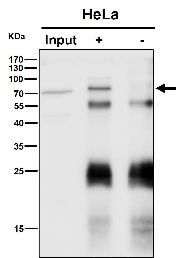 p70 S6 Kinase Ab