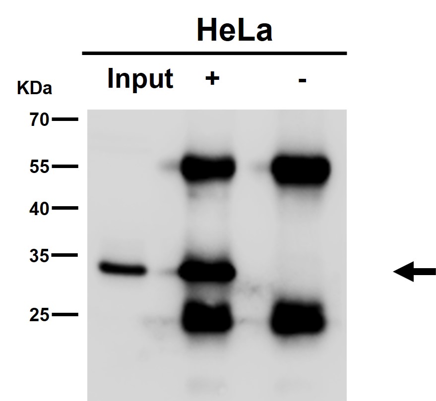 CDK5 Ab