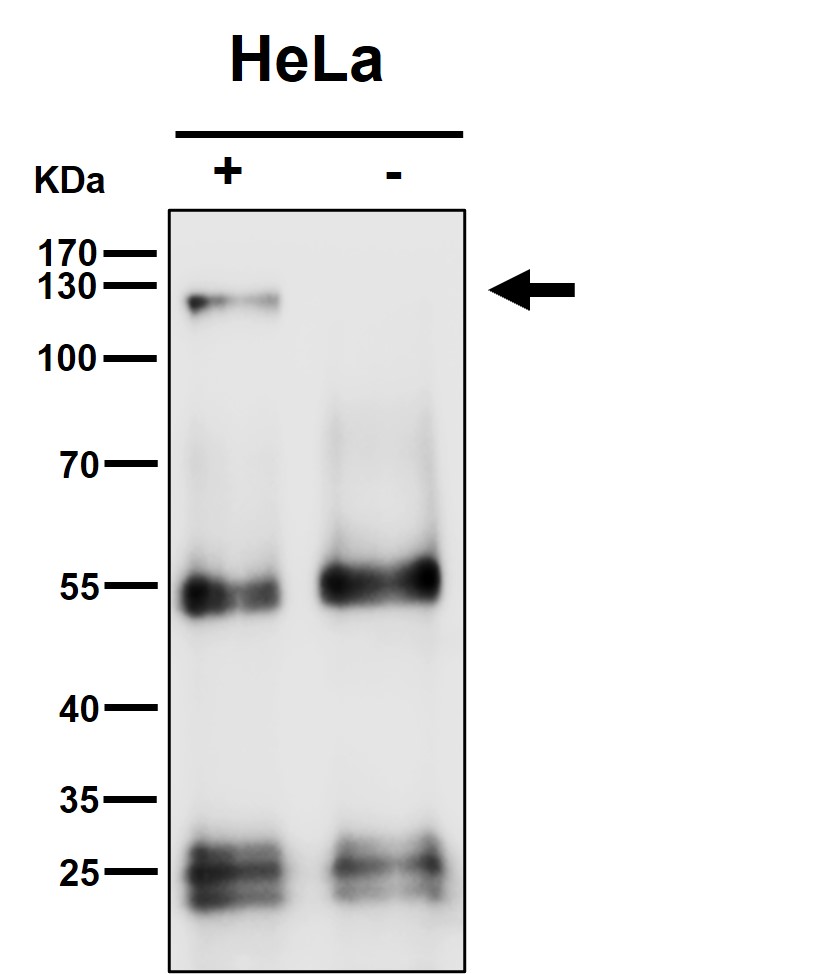 ATP citrate synthase Ab