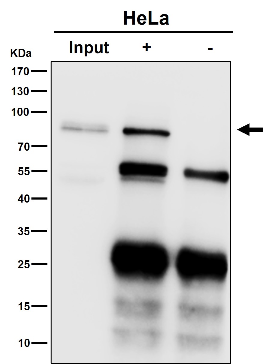 STAT1 Ab