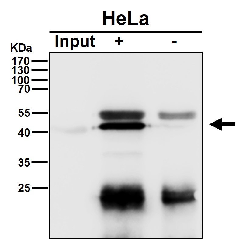 HDAC8 Ab