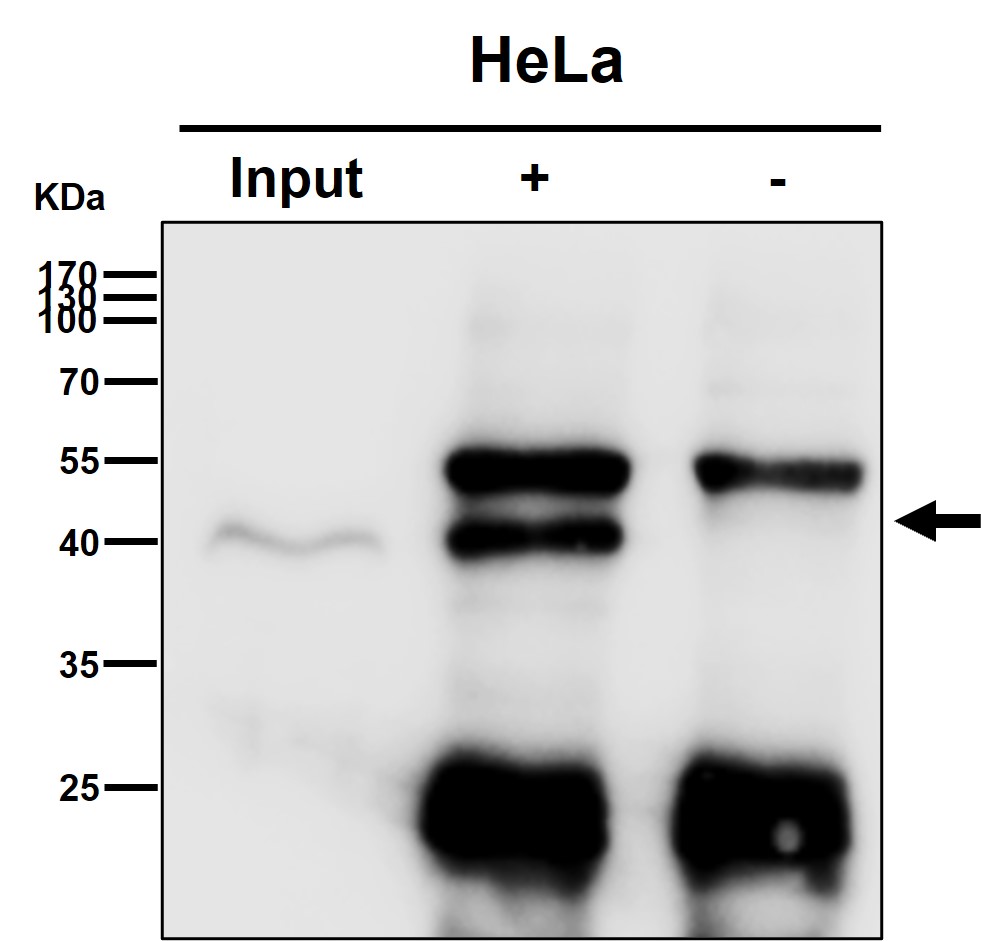 p-PDHA1 (S293) Ab