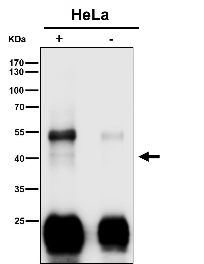 Clusterin Ab