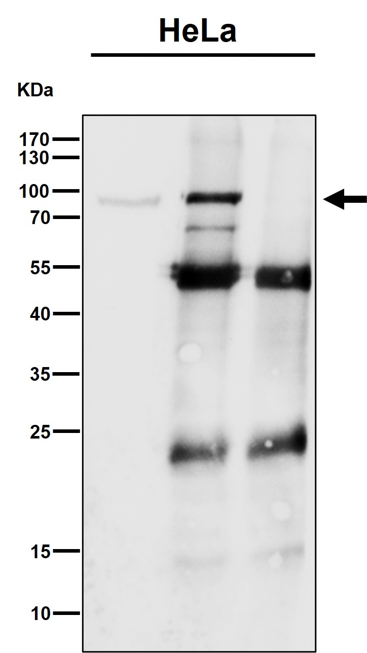 CSDE1 Ab