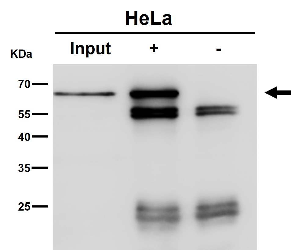 Reticulon 4 receptor Ab