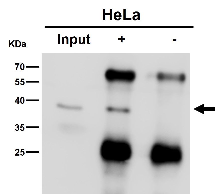 AKR1C3 Ab