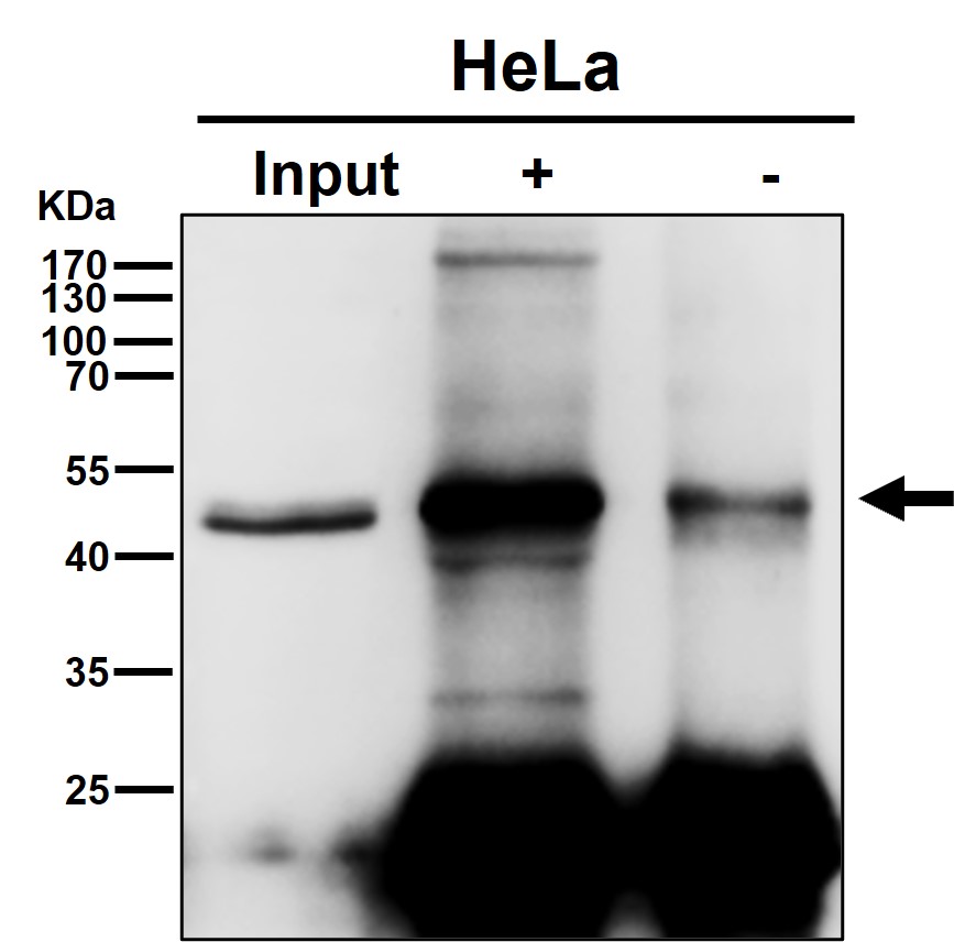 CELF 1 Ab