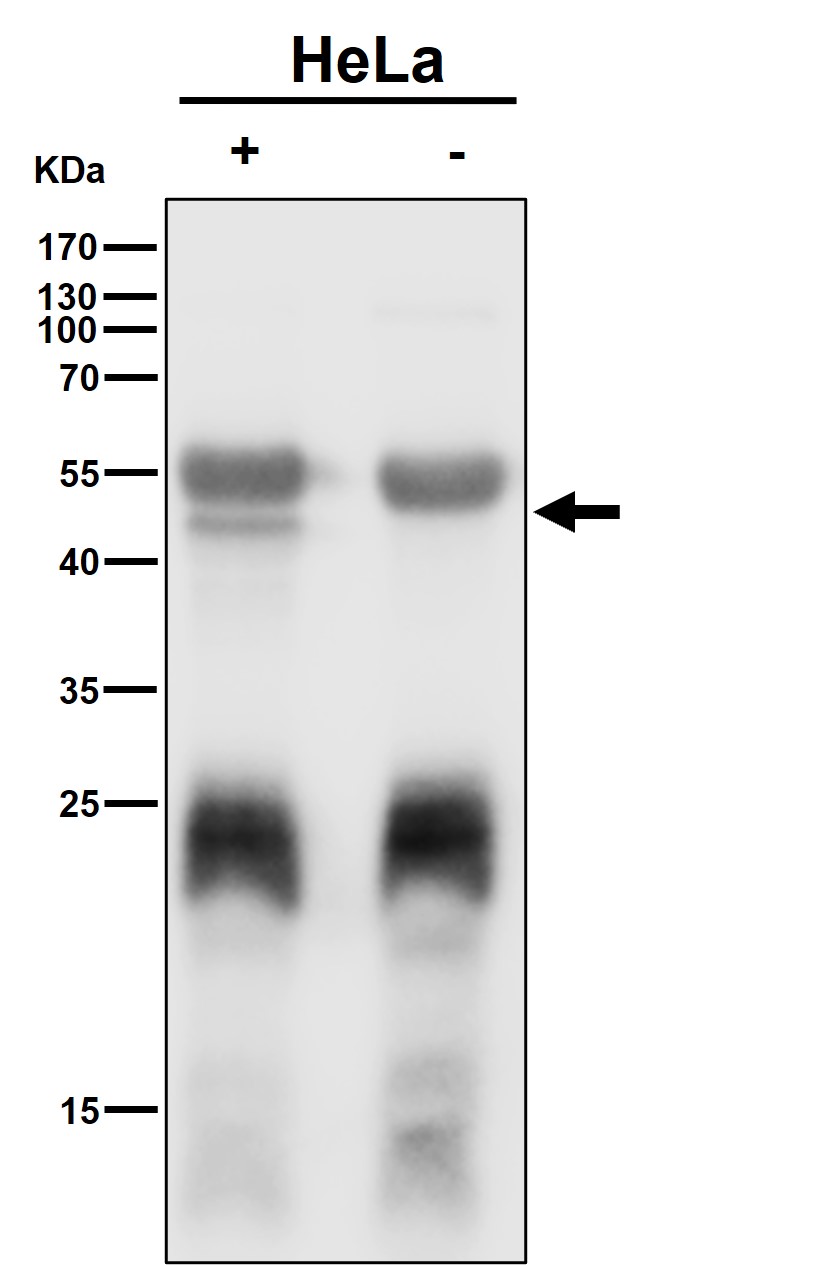 Squalene synthase Ab