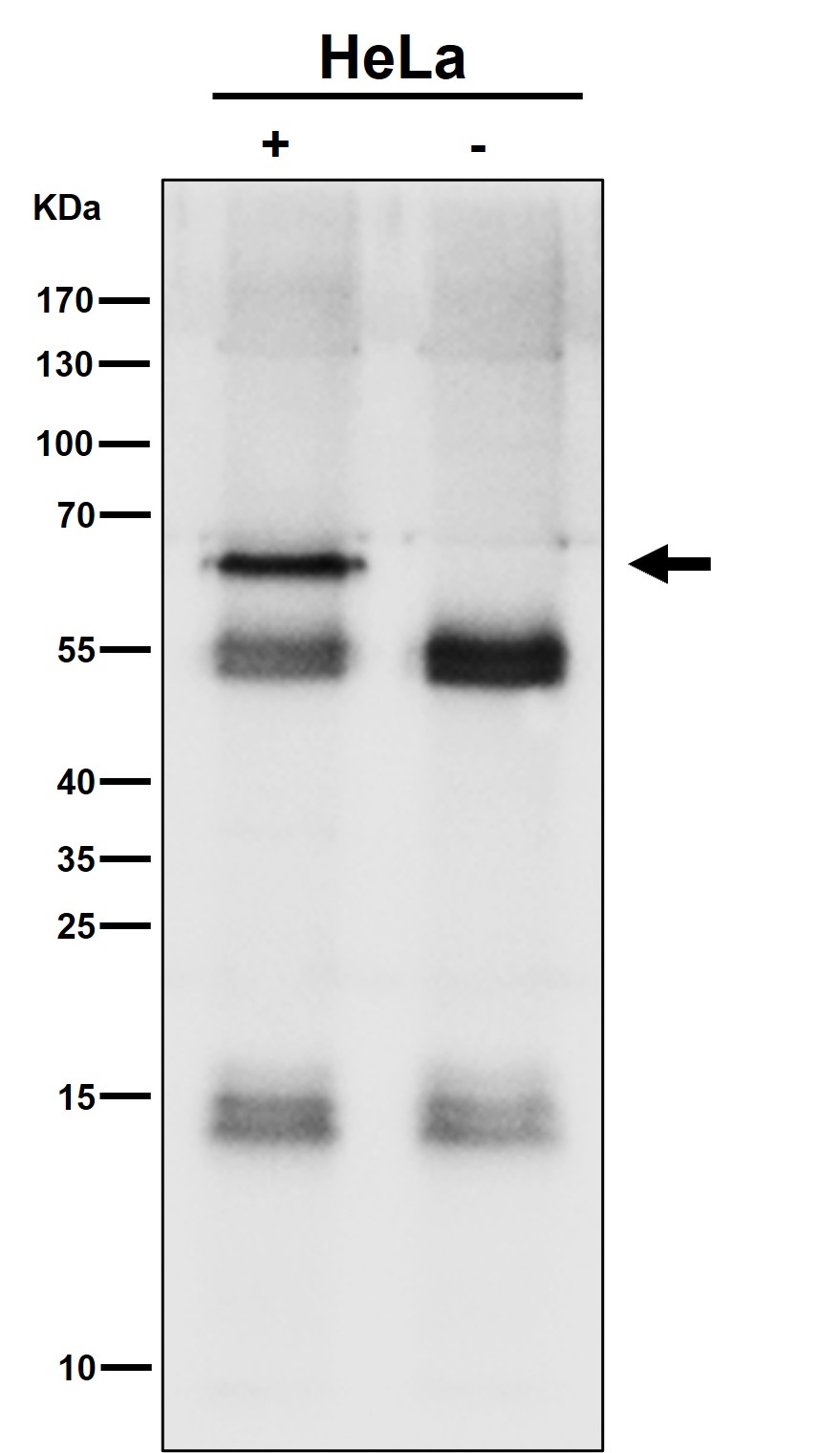 SYVN1 Ab