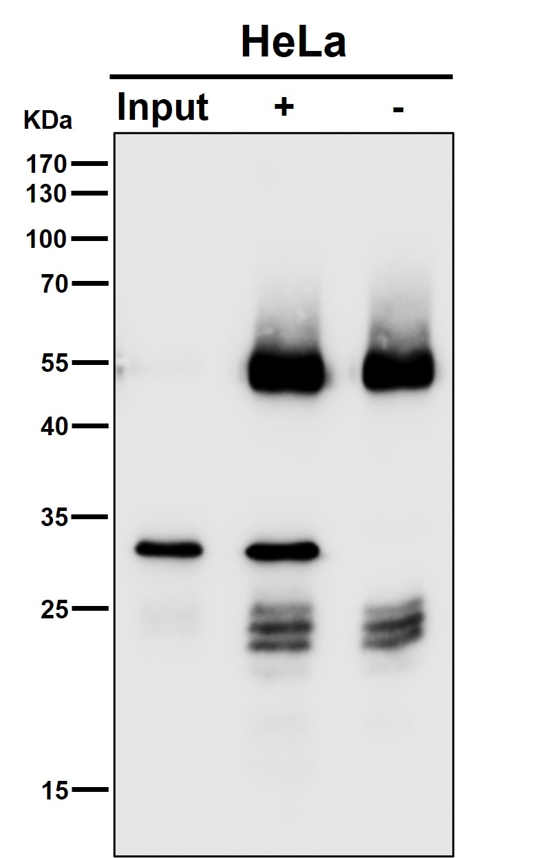 CHMP2B Ab