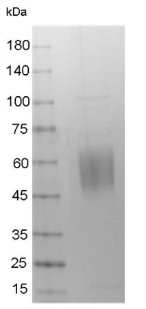 Recombinant CD28 ECD, Human, His-SUMO Tag, HEK293