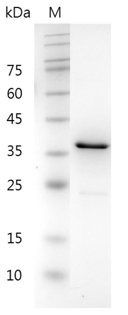 Recombinant CHI3L1 (Chitinase-3-like protein 1), Human, AF