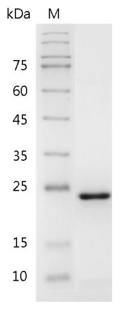 Recombinant FGF-21 (Fibroblast growth factor-21), Human, AF