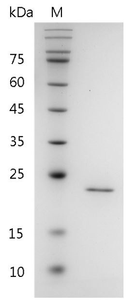 Recombinant FGF-3 (Fibroblast growth factor-3), Human, AF