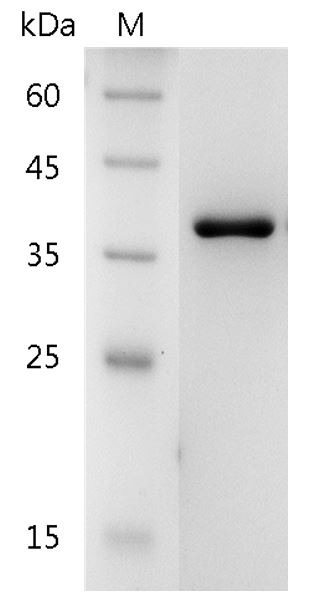 Recombinant Galectin-8, Human, AF