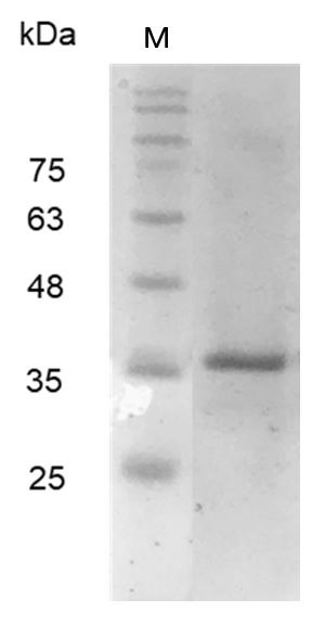 Recombinant Galectin-9, Human, AF