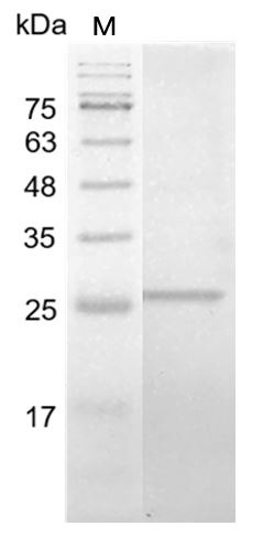 Recombinant GIF (Gastric intrinsic factor), Human, AF