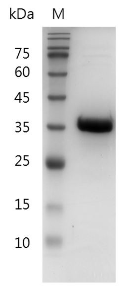 Recombinant HDGF (Hepatoma-derived growth factor), Human, AF