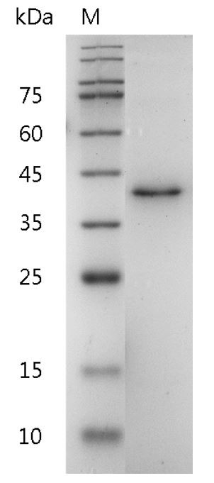 Recombinant IL-12 p40 (Interleukin-12 p40), Human, AF