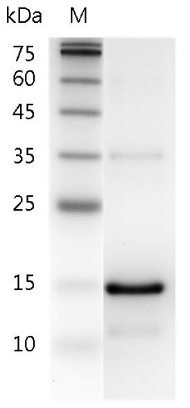 Recombinant IL-21 (Interleukin-21), Human, AF