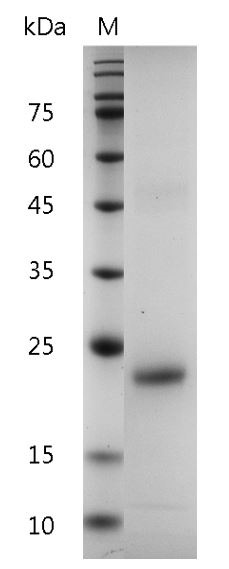 Recombinant IL-6 (Interleukin-6), Human, AF